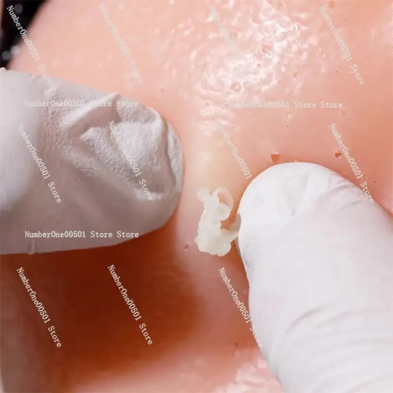 Pimple Popping Stress Toy